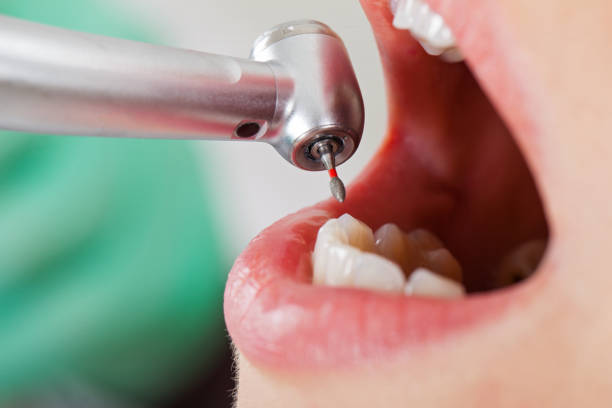 Best Emergency Treatment for Oral Infections in Pleasant Gap, PA